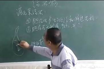 胆结石的物质、颜色及形态