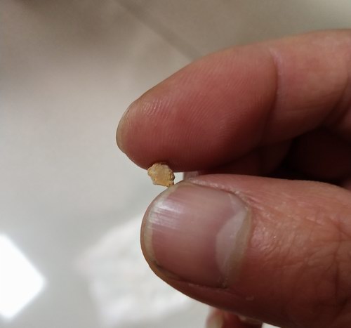 50�������ų����������ܽ�ʯ