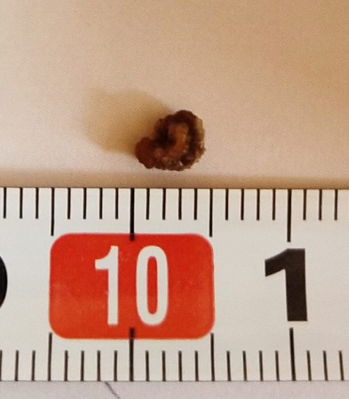 ���ָ���������µ��������ܽ�ʯ