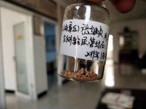 50�������ų����������ܽ�ʯ