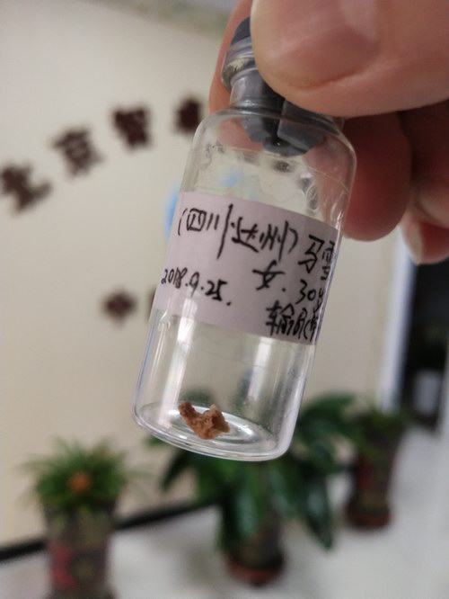 30��Ů���ų�������ܽ�ʯ