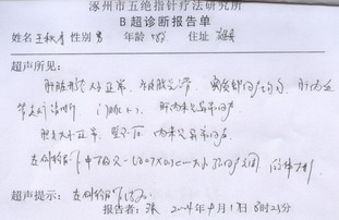 右肝内胆管结石合并左输石