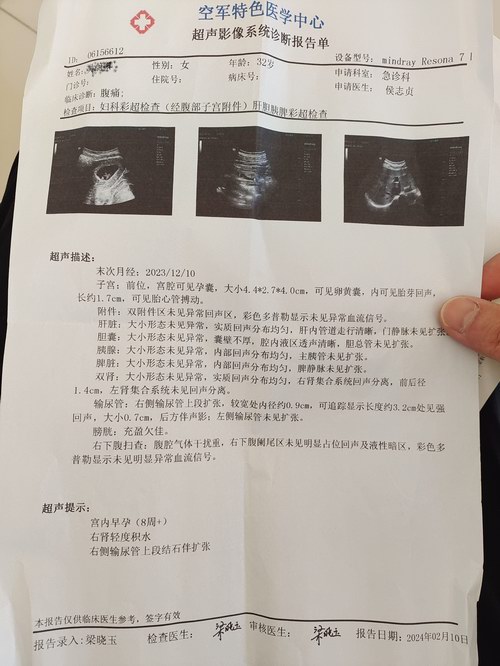 怀孕8周孕妈妈输尿管结石病案