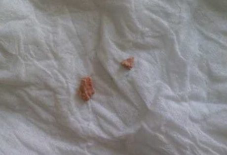 ��ʯ���κ�����ָ���Ʒ����µĽ�ʯ