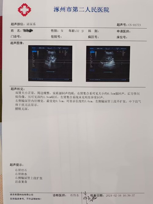 怀孕8周孕妈妈输尿管结石病案