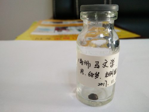 ���ָ���Ʒ�����������������ܽ�ʯ