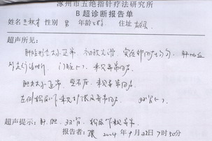 右肝内胆管结石合并左输石