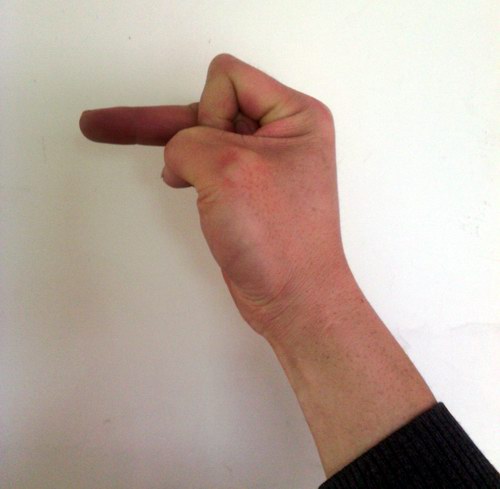 长期用五绝指针疗法手指会变形吗?