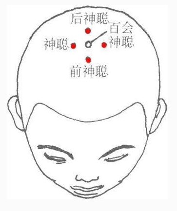 经外奇穴—四神聪穴
